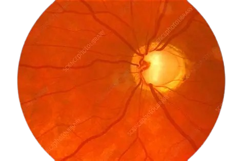 Fundus scan for glaucoma and retina monitoring
